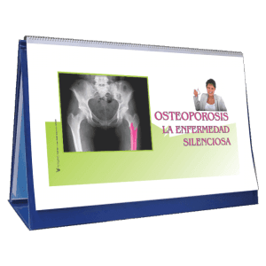 Libro rotafolio educativo sobre Osteoporosis