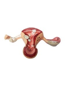 Modelo-Patologias-Utero-y-Ovarios.jpg
