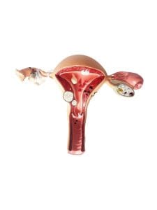 Modelo-Patologias-Utero-y-Ovarios-cervix.jpg